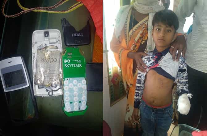 ऑनलाईन मागवलेल्या मोबाईलचा स्फोट, चिमुकल्याच्या हाताची पाचही बोटं तुटली!