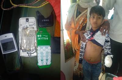 ऑनलाईन मागवलेल्या मोबाईलचा स्फोट, चिमुकल्याच्या हाताची पाचही बोटं तुटली!