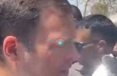 राहुल गांधींच्या चेहऱ्यावर लेझर लाईट, सुरक्षेत मोठी चूक?