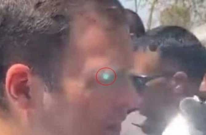 राहुल गांधींच्या चेहऱ्यावर लेझर लाईट, सुरक्षेत मोठी चूक?