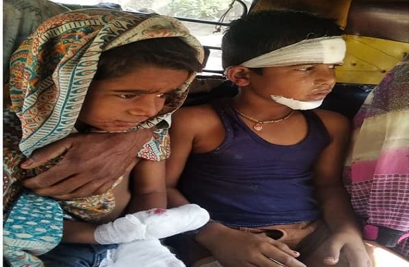 औरंगाबादेत मोबाईल बॅटरीशी खेळताना स्फोट, दोन मुलं जखमी
