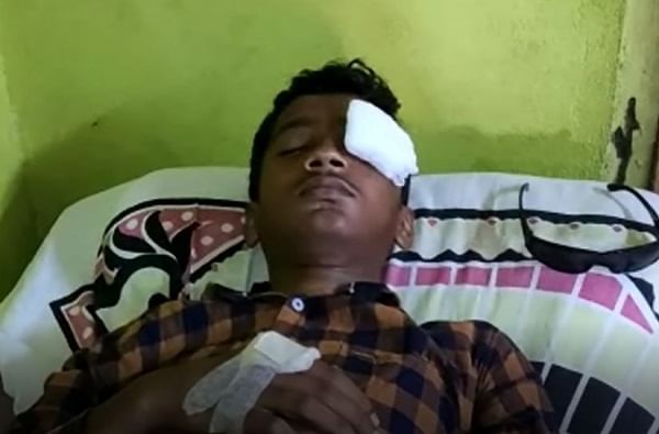 गेम खेळताना मोबाईल स्फोट, तरुणाचा डोळा निकामी गेम खेळताना मोबाईल स्फोट, तरुणाचा डोळा निकामी