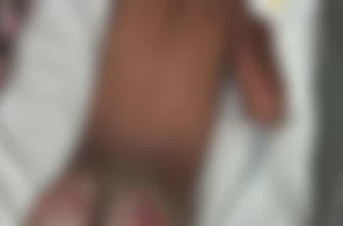 उन्हाने तापलेल्या फरशीवर कपडे काढून बसवलं, चिमुकल्याचा पार्श्वभाग जळाला