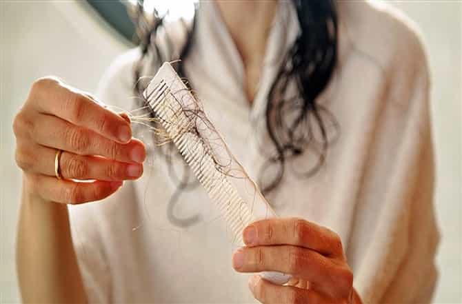 केस गळती रोखण्यासाठी या सहा गोष्टींची काळजी घ्या