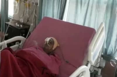 डॉक्टरांचं महिलेला जीवदान, चोरट्यांनी डोळ्यात खुपसलेला विळा बाहेर काढला