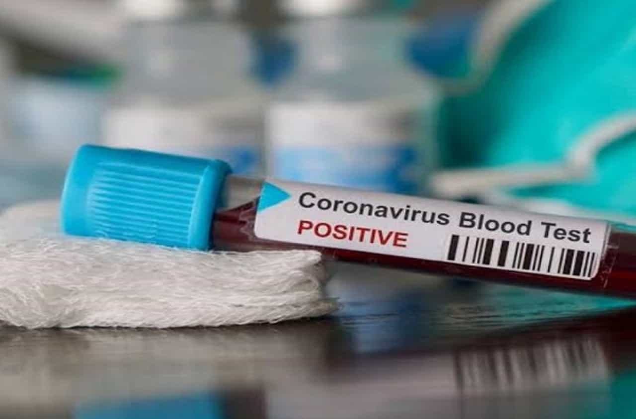 Corona : नाशकात कोरोनाचा पहिला बळी, मालेगावात कोरोनाचा शिरकाव