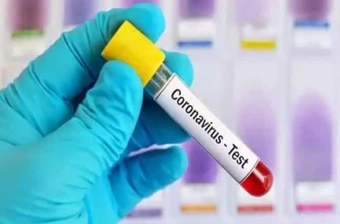 Corona : जळगावात कोरोनाचा तिसरा रुग्ण; 60 वर्षीय महिलेला कोरोनाची लागण