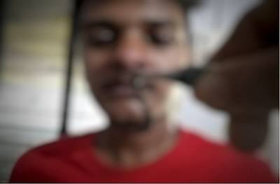 पाणी पिताना नाकात जळू शिरला, तब्बल 25 दिवस समजलंच नाही, डॉक्टरांनी भन्नाट आयडिया करुन बाहेर काढला!