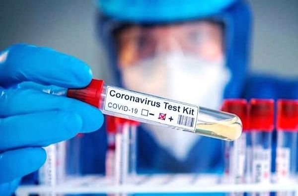 Solapur Corona | 40 कोरोना बळींची माहिती लपवली, सोलापुरातील तीन रुग्णालयांना कारणे दाखवा नोटीस