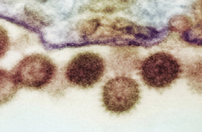 कोरोनानंतर महाराष्ट्रावर नव्या विषाणूजन्य रोगाचं सावट, पालघर जिल्हाधिकाऱ्यांकडून सतर्कतेचा इशारा