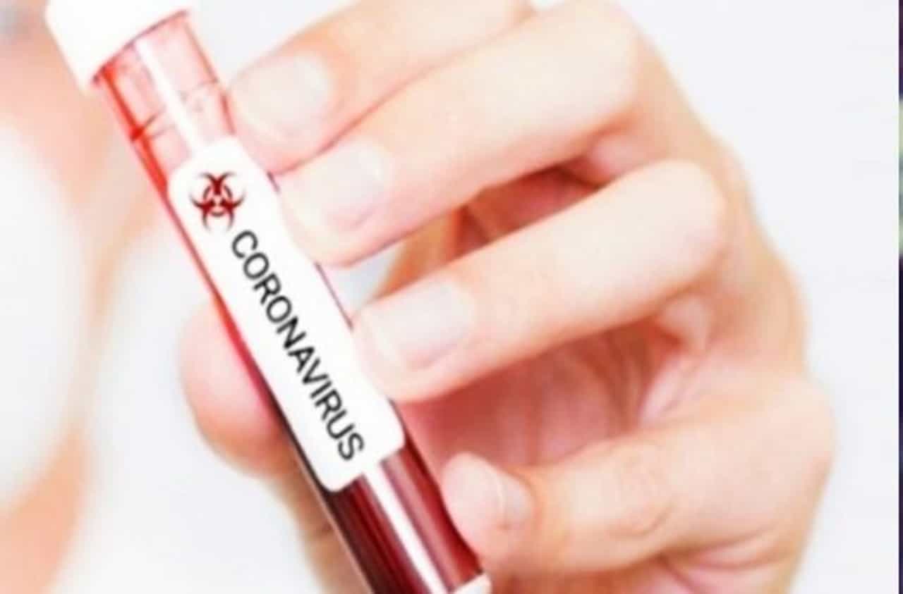 Photos: सुरु होण्याआधीच ही लीग अडचणीत, 48 खेळाडूंना कोरोना संसर्ग