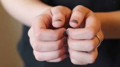 Health | सावधान! नखांचे तुटणे ‘या’ गंभीर आजारांचे लक्षण, वेळीच काळजी घेण्याची गरज...