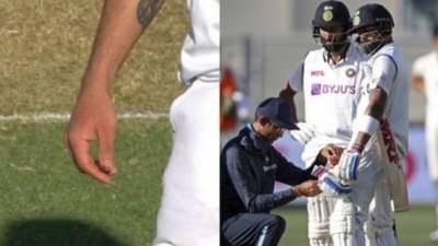 IND VS AUS | विषय गंभीर पण भाऊ खंबीर, स्टार्कच्या बोलिंगवर दुखापत, रक्त आलं तरी विराट खेळतच राहिला!