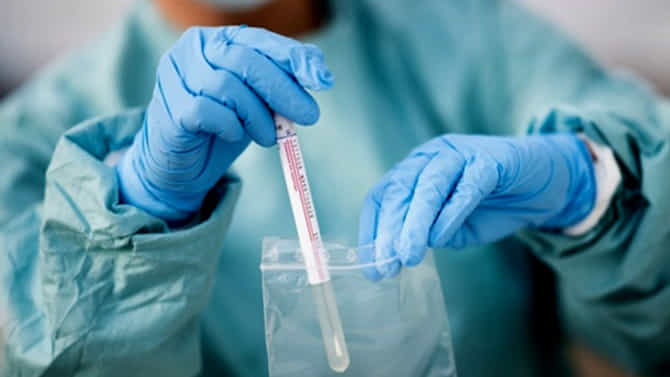 धक्कादायक, औरंगाबादमध्ये कोरोना झाल्यानंतर महिलेच्या शरीरात पू भरला; भारतातील पहिलीच घटना