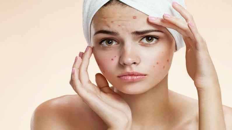 Beauty Care | तुम्हालाही आहेत का ‘या’ वाईट सवयी? थांबा! अन्यथा होईल चेहऱ्यासह आरोग्याचे नुकसान!