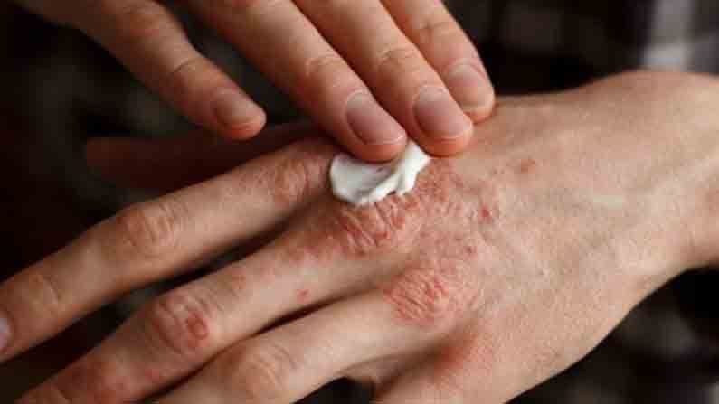 हाताची नखं एकमेकांवर घासल्याने होतात अनेक फायदे, 'या' आजारापासून मिळते  सुटका - Marathi News | benefits of rubbing nails | Latest health News at  Lokmat.com