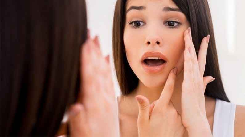 Skin Care | 'ब्लाइंड पिंपल्स'च्या समस्येने हैराण? 'या' उपायांनी मिळेल आराम...