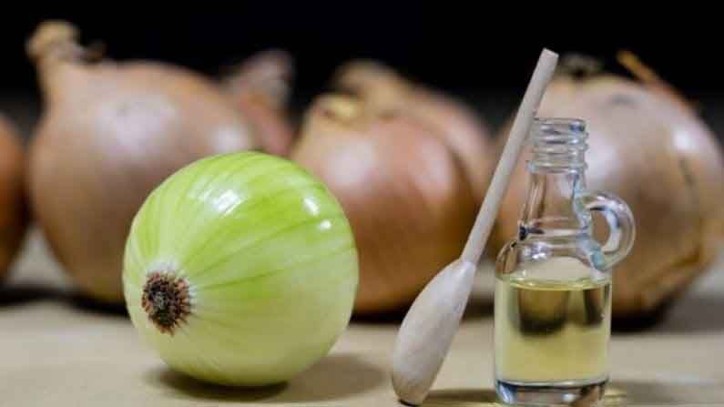 Onion Oil | कांद्याच्या तेलात लपलेत अनेक औषधी गुण, केस गळतीच्या समस्येवरही रामबाण उपाय!