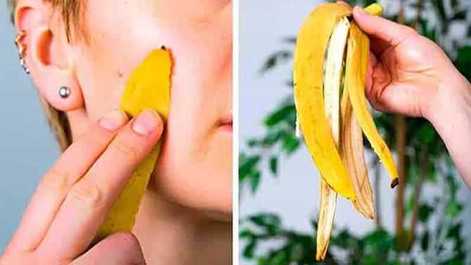 Beauty hacks | चमकदार चेहरा आणि पांढरे दात हवेयत? मग अशाप्रकारे वापर ‘केळ्याचे साल’