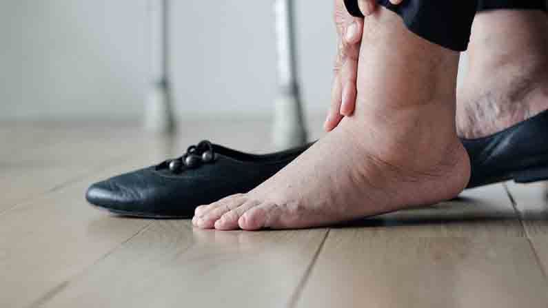Swollen Feet Edema | पाय आणि गुडघ्याच्या सुजेकडे दुर्लक्ष करताय? होऊ शकतो 'हा' गंभीर आजार! Swollen Feet Edema | पाय आणि गुडघ्याच्या सुजेकडे दुर्लक्ष करताय? होऊ शकतो 'हा' गंभीर आजार!