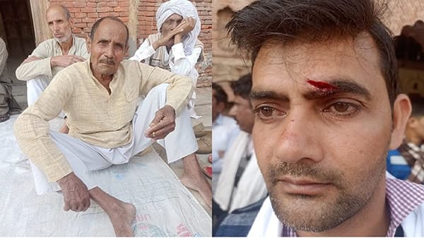 उत्तर प्रदेशात शेतकरी आणि भाजप कार्यकर्त्यांमध्ये झडप, अनेक जण जखमी