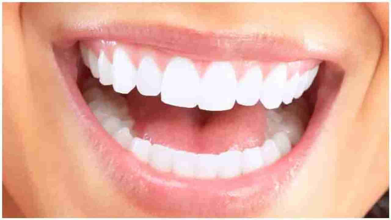 Teeth : दातांचा पिवळेपणा घालवण्यासाठी हे घरगुती उपाय नक्की करा!
