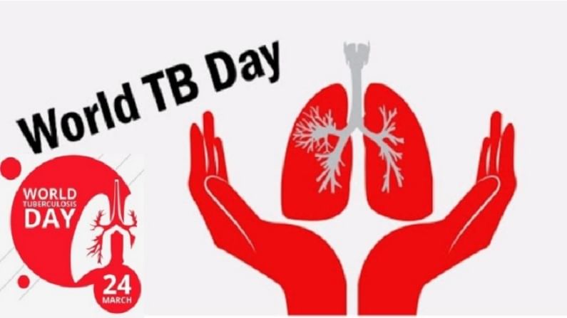 World Tuberculosis Day 2021 : प्रत्येक टीबी संक्रामक नसतो,जाणून घ्या 'या' आजाराशी संबंधित महत्वाची माहिती