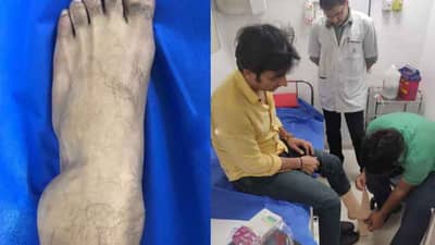 पायाला गंभीर दुखापत, उभं राहण्याची शाश्वती नाही, तरीही ‘या’ अभिनेत्याने पूर्ण केला नाटकाचा शो!