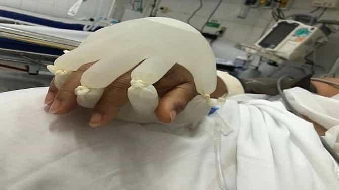 हे फक्त हात नाहीत, जगण्याची आशा आहेत, महामारीतलं काळीज चिरणारं वास्तव