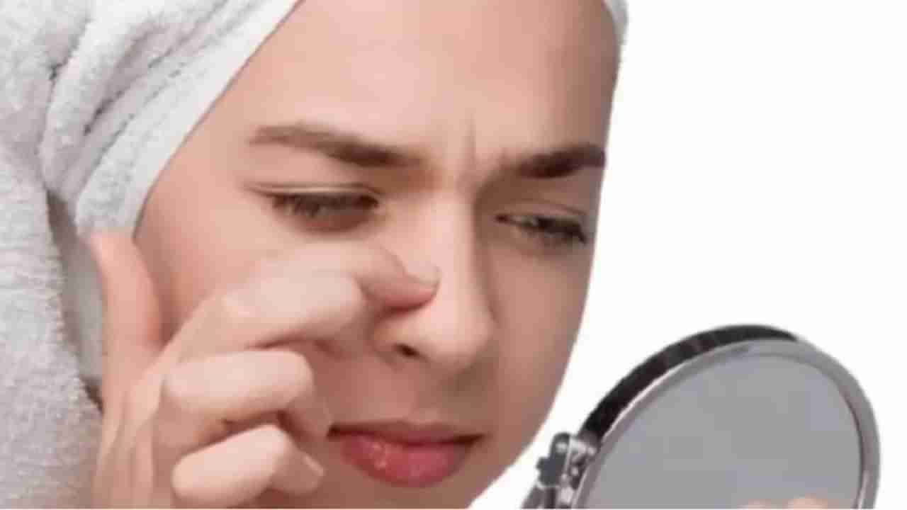 नाका जवळील त्वचेचा तेलकटपणा घालवण्यासाठी या घरगुती टिप्स फाॅलो करा