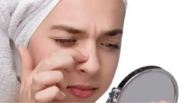नाका जवळील त्वचेचा तेलकटपणा घालवण्यासाठी 'या' घरगुती टिप्स फाॅलो करा