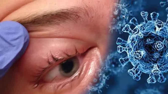 Mucormycosis : म्युकरमायकोसिसची भीती वाटतेय? मग ICMR ने सुचवलेल्या या गोष्टी कराच...