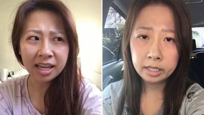 तोंडाचं ऑपरेशननंतर महिलेला धक्का, स्वतःची बोलण्याची पद्धत विसरुन दुसरीच सुरु, योगायोग नाही तर या आजाराने ग्रस्त