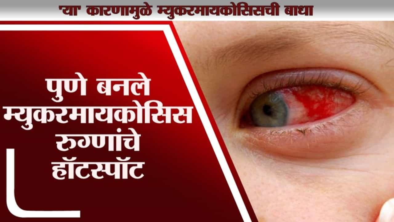 Pune जिल्हा बनला Mucormycosis चा हॉटस्पॉट, कारण ऐकूण व्हाल थक्क