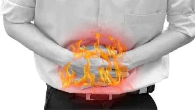 Home remedies for Acidity : ‘हे’ पदार्थ ज्याने लगेच थांबेल अॅसिडिटीची समस्या, वाचा !