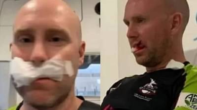 Pakistan Super League : वेगवान चेंडू तोंडावर आदळा, विकेटकीपर जखमी, तोंडाला सात टाके