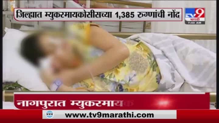 Nagpur | नागपुरात म्युकोरमायकोसिसचा कहर, आतापर्यंत 1 हजार 385 रुग्णांची नोंद Nagpur | नागपुरात म्युकोरमायकोसिसचा कहर, आतापर्यंत 1 हजार 385 रुग्णांची नोंद