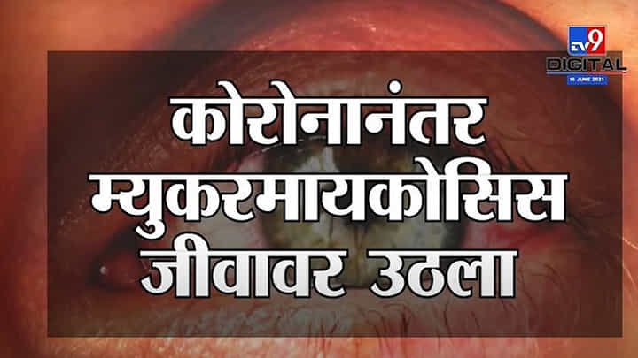 Mucormycosis मुळे Ahmednagar मध्ये चिमुरडीचा मृत्यू, साताऱ्यात कोरोनाहून 7 पट जास्त Black Fungus बळी Mucormycosis मुळे Ahmednagar मध्ये चिमुरडीचा मृत्यू, साताऱ्यात कोरोनाहून 7 पट जास्त Black Fungus बळी