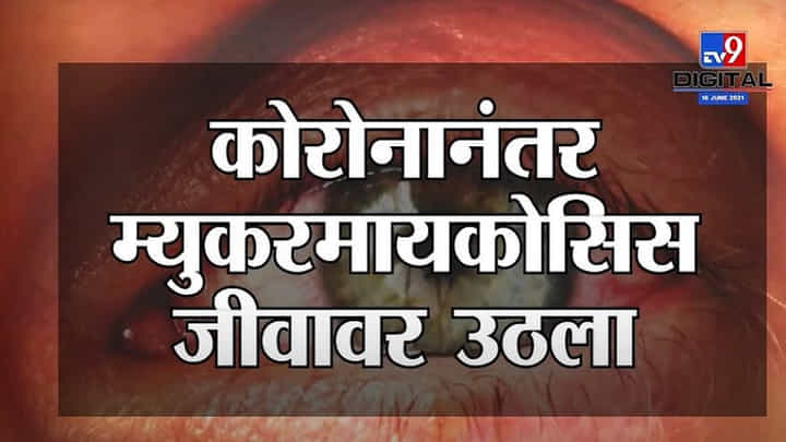 Mucormycosis मुळे Ahmednagar मध्ये चिमुरडीचा मृत्यू, साताऱ्यात कोरोनाहून 7 पट जास्त Black Fungus बळी Mucormycosis मुळे Ahmednagar मध्ये चिमुरडीचा मृत्यू, साताऱ्यात कोरोनाहून 7 पट जास्त Black Fungus बळी