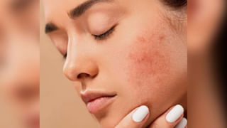 Skin care : ‘हे’ खास फेसपॅक चेहऱ्याला लावा आणि चेहऱ्याच्या समस्यांना बाय बाय बोला!