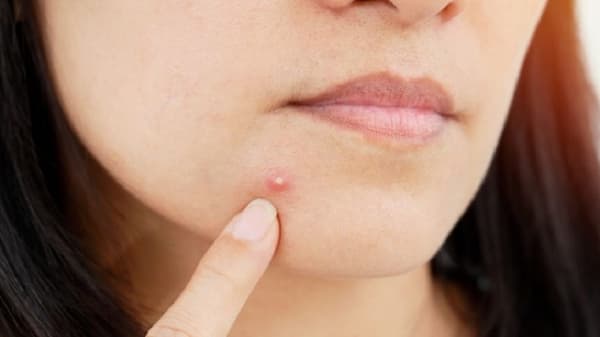 Skin Care : पपई आणि मधाचा फेसपॅक चेहऱ्याला लावा आणि पिंपल्सची समस्या दूर करा!