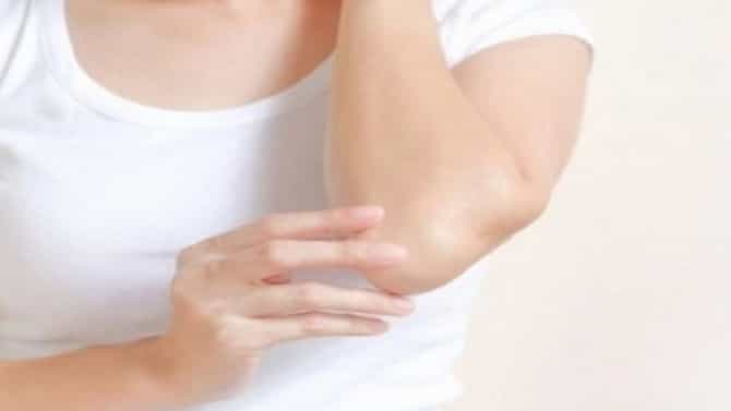Skin Care : हातावरील काळपटपणा काढण्यासाठी हे घरगुती उपाय नक्की ट्राय करा!