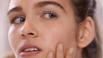 Skin Care : हे घरगुती उपाय करा आणि हायपरपिग्मेंटेशनची समस्या दूर करा!