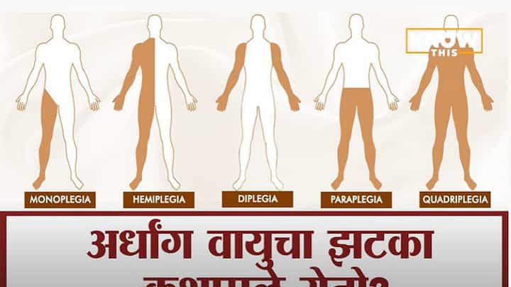 Know this : Paralysis Attack कधी येतो, त्याची लक्षणं काय? Know this : Paralysis Attack कधी येतो, त्याची लक्षणं काय?