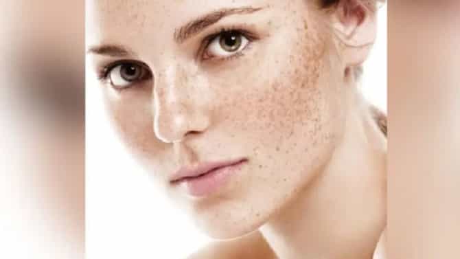 Skin Care Tips : या तुमच्या चुकांमुळे पिगमेंटेशनची समस्या वाढते, वाचा याबद्दल अधिक!