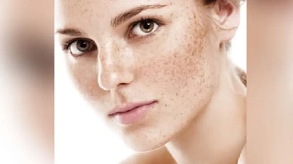 Skin Care Tips : या तुमच्या चुकांमुळे पिगमेंटेशनची समस्या वाढते, वाचा याबद्दल अधिक!