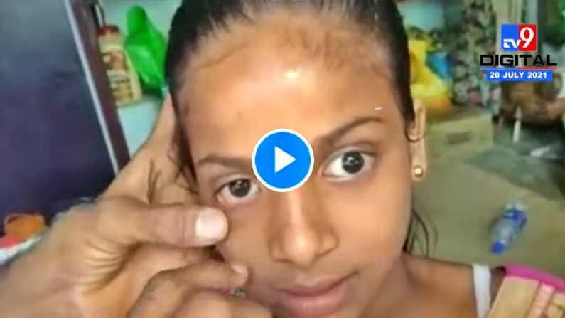 VIDEO: लातूरमध्ये मुलीच्या डोळ्यातून तांदूळ, ज्वारी व दगडाचे कण निघतात, कारण काय?