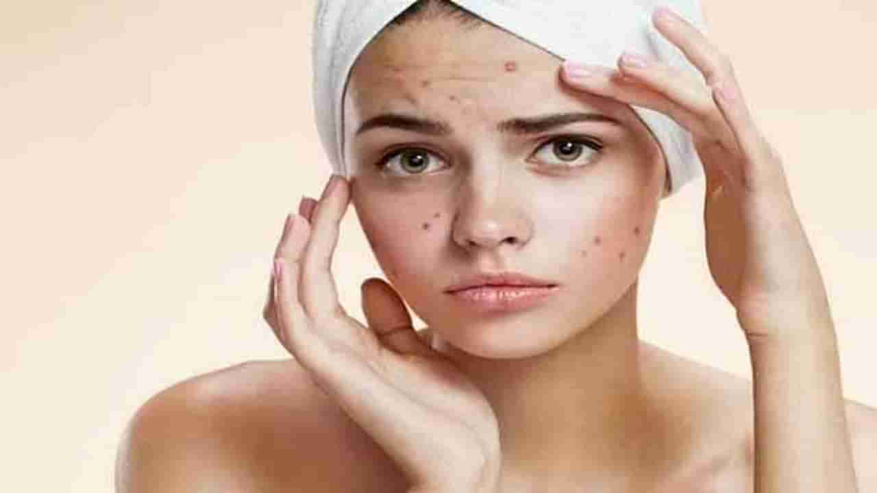 Skin Care : चेहऱ्याच्या समस्या दूर करण्यासाठी हा फेसपॅक वापरा ! 