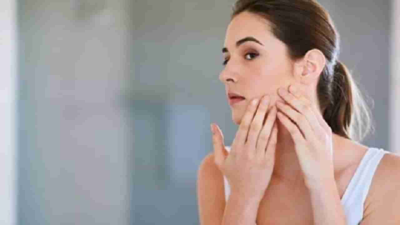 Skin Care : तेलकट त्वचेमुळे पिंपल्सची समस्या वाढत आहे? मग हे घरगुती उपाय करा!