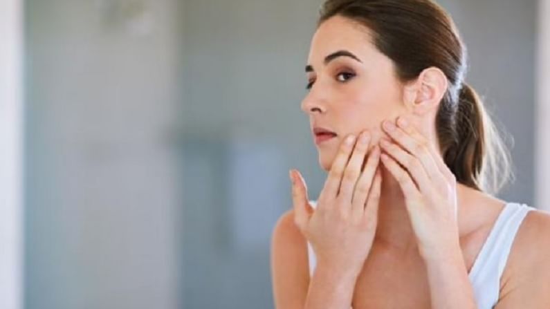 Skin Care : तेलकट त्वचेमुळे पिंपल्सची समस्या वाढत आहे? मग 'हे' घरगुती उपाय करा!